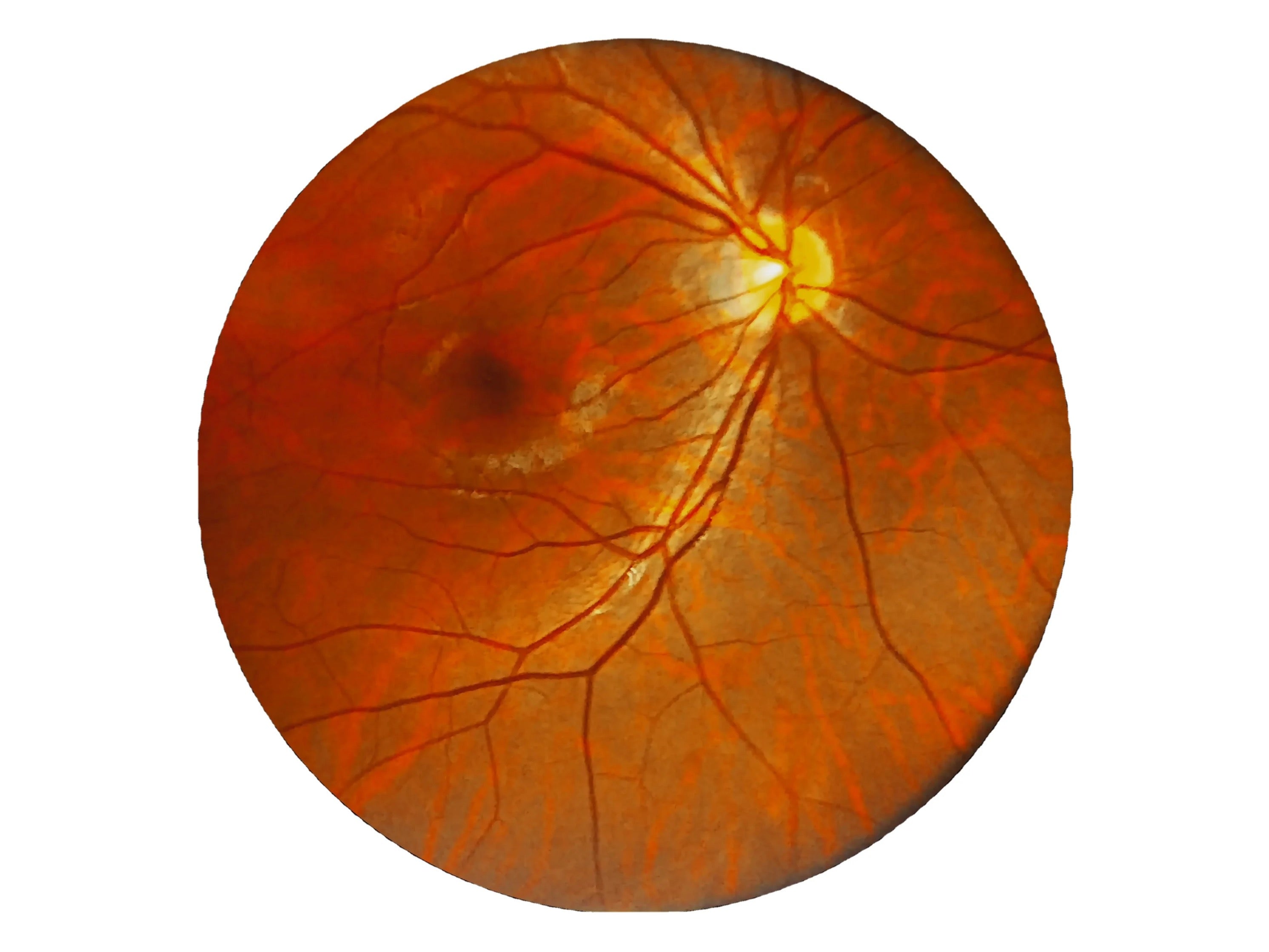 Cámara Retinal Portátil CFC-X / Mocular Medical