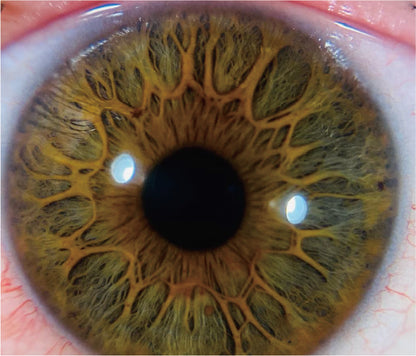 Adaptador de Imagen Ocular QuickVue Plus