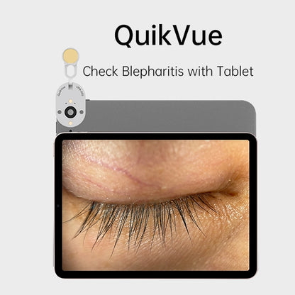 Adaptador de Imagen Ocular QuickVue Plus