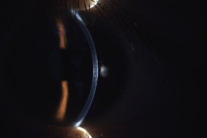 Analizador de Superficie Ocular DA-1