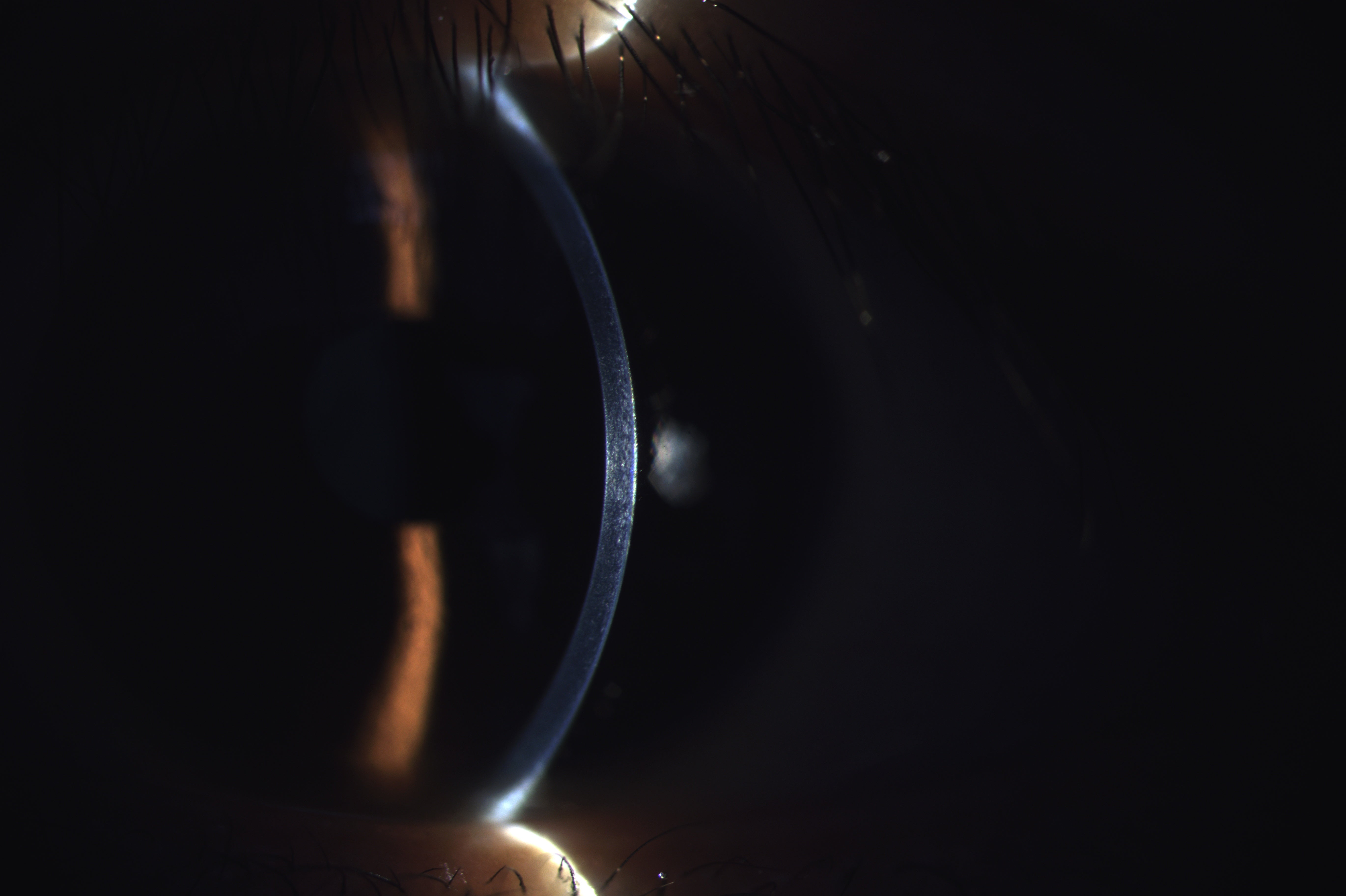 Analizador de Superficie Ocular DA-1