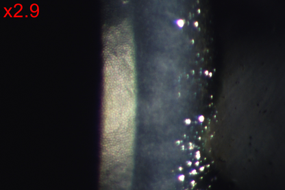 Analizador de Superficie Ocular DA-1