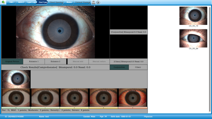 Analizador de Superficie Ocular Portátil DA-2