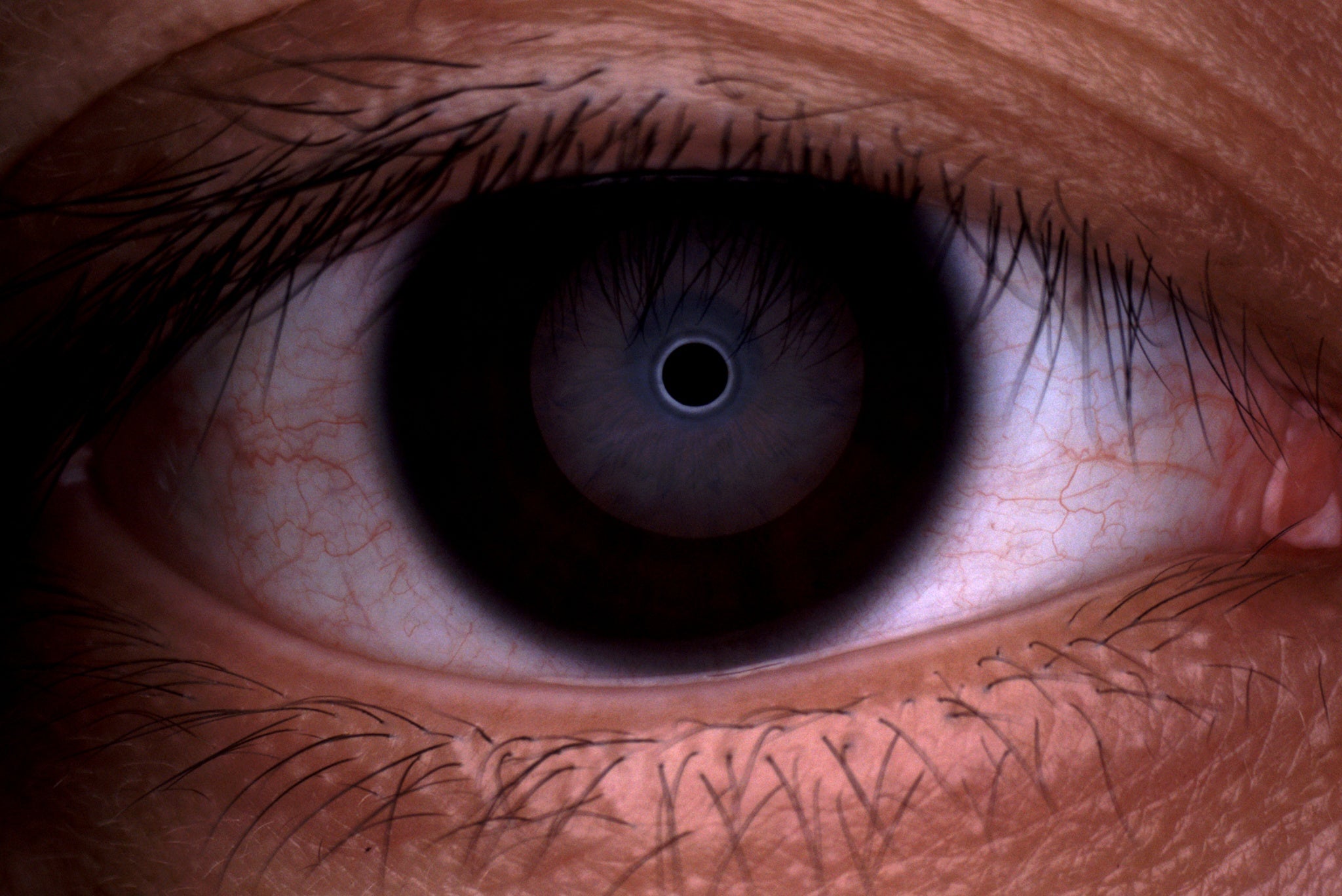 Analizador de Superficie Ocular Avanzado DA-3