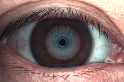 Analizador de Superficie Ocular Avanzado DA-3