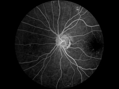 Cámara Retinal No Midriática + Angiográfo SK-650B