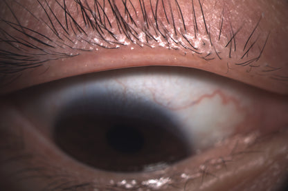 Analizador de Superficie Ocular DA-1