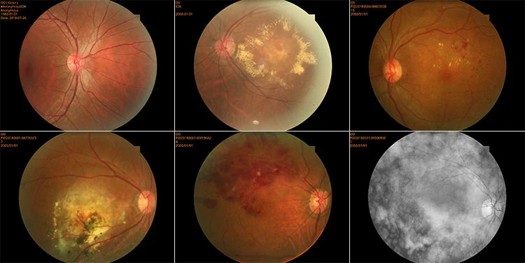 Cámara Retinal No Midriática RetiCam-5100 PRO (*Angio/AutoFluor)