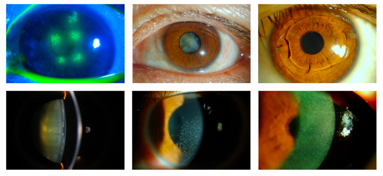 Lámpara de Hendidura LS-4 SK Med