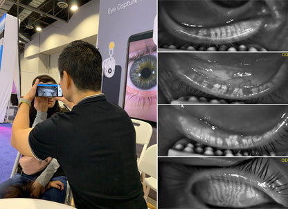 Meibógrafo Portátil MeiboVue VCM-100