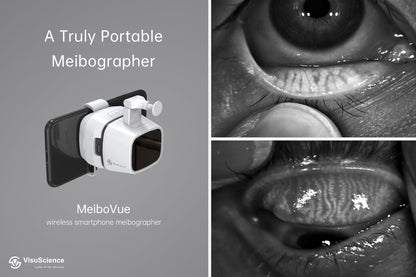 Meibógrafo Portátil MeiboVue VCM-100