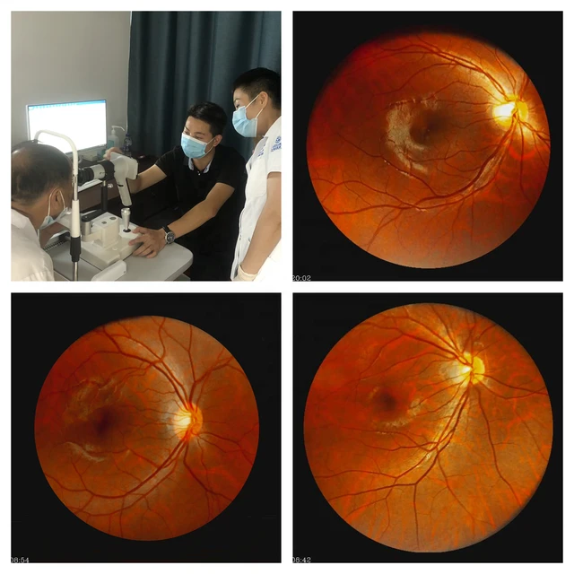 Cámara Retinal Portátil CFC-X / Mocular Medical
