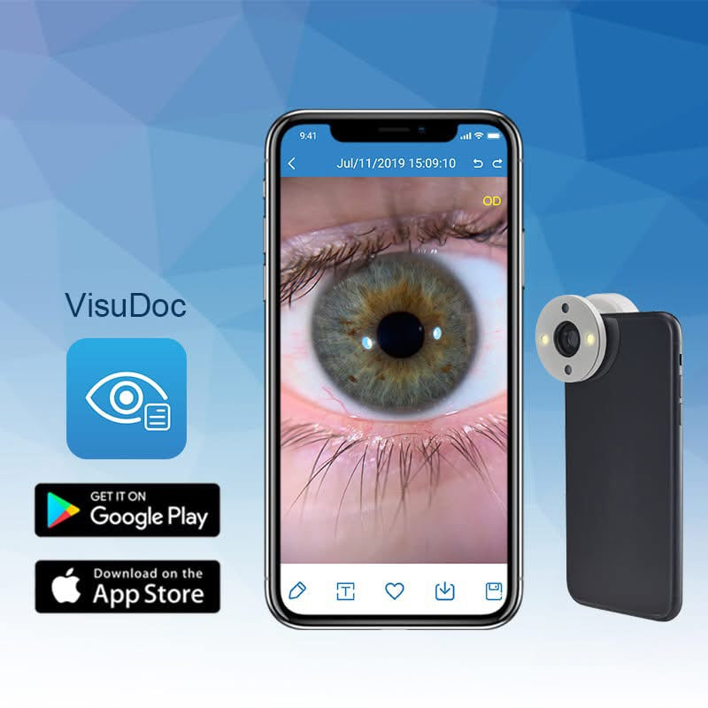 Adaptador de Imagen Ocular QuickVue Plus