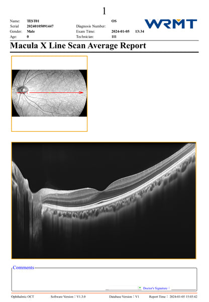 OCT Velite C-3000 OCT-ANGIO Alta Velocidad / Ultra Alta Resolución