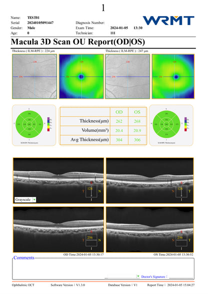 OCT Velite C-3000 OCT-ANGIO Alta Velocidad / Ultra Alta Resolución