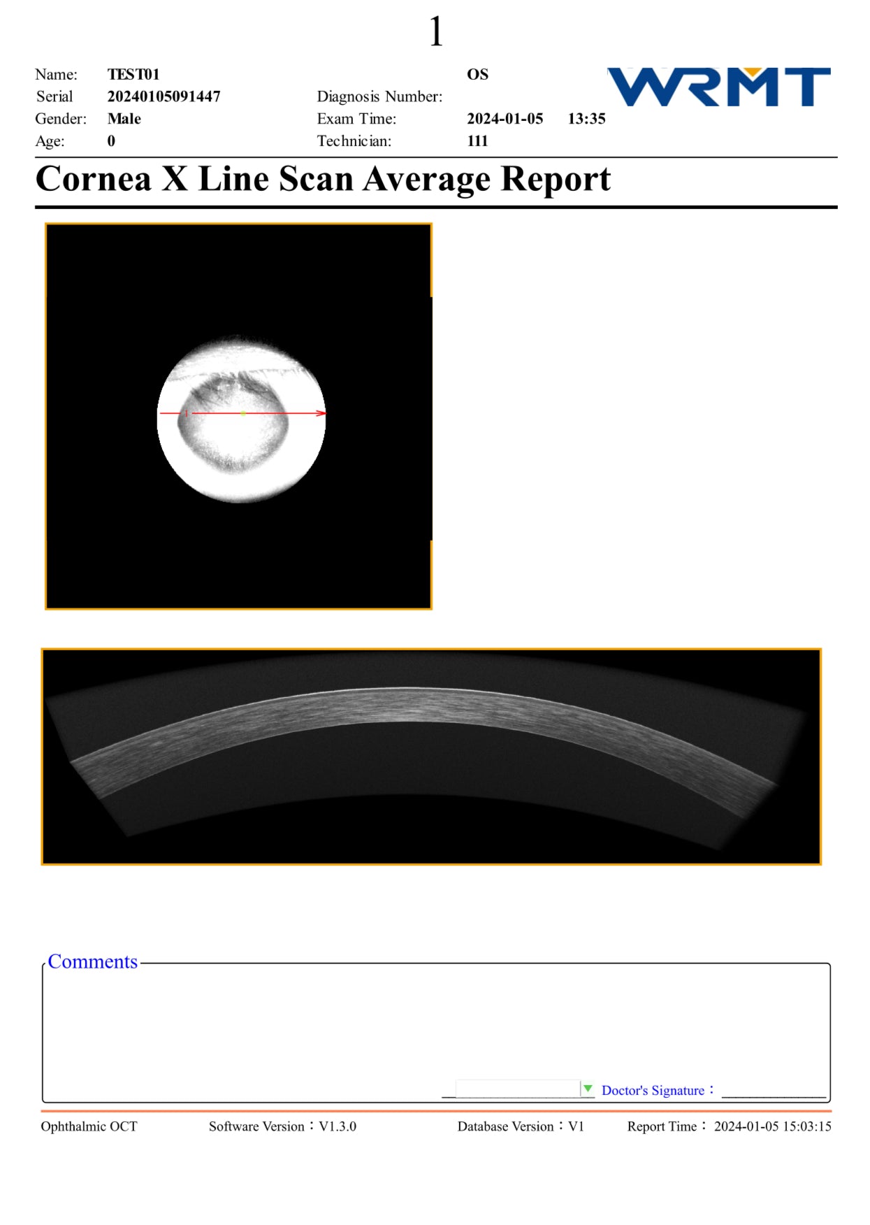 OCT 8K Velite C-2000 A.I.