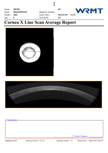 OCT 8K Velite C-2000 A.I.