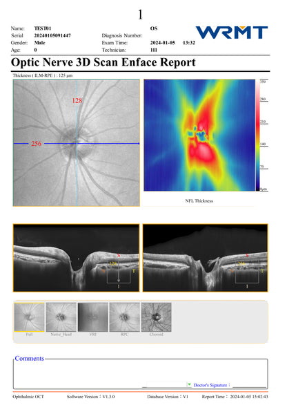 OCT 8K Velite C-2000 A.I.