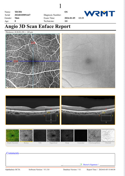OCT Velite C-3000 OCT-ANGIO Alta Velocidad / Ultra Alta Resolución