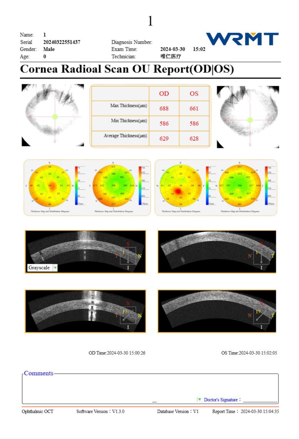 OCT Velite C-3000 OCT-ANGIO Alta Velocidad / Ultra Alta Resolución