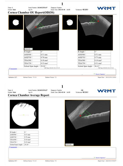 OCT Velite C-3000 OCT-ANGIO Alta Velocidad / Ultra Alta Resolución