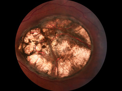 Cámara Retinal No Midriatica SK-680 A