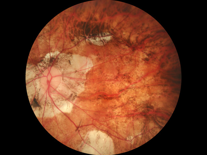 Cámara Retinal No Midriatica SK-680 A