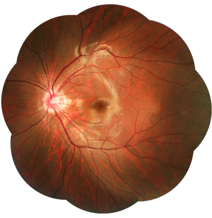 Cámara Retinal No Midriática + Angiográfo SK-650B