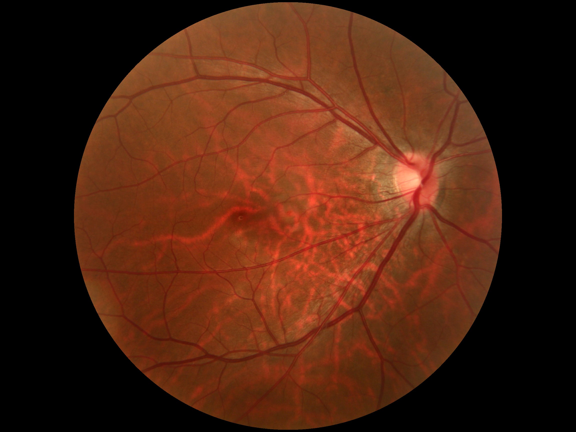 Cámara Retinal No Midriática + Angiográfo SK-650B