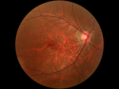 Cámara Retinal No Midriática + Angiográfo SK-650B