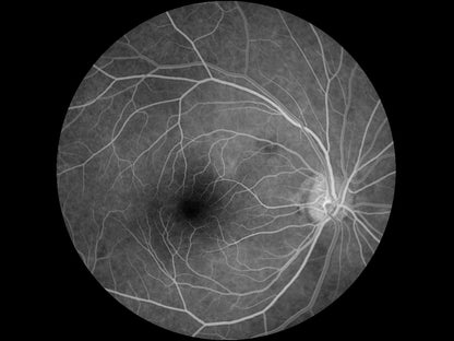 Cámara Retinal No Midriática + Angiográfo SK-650B