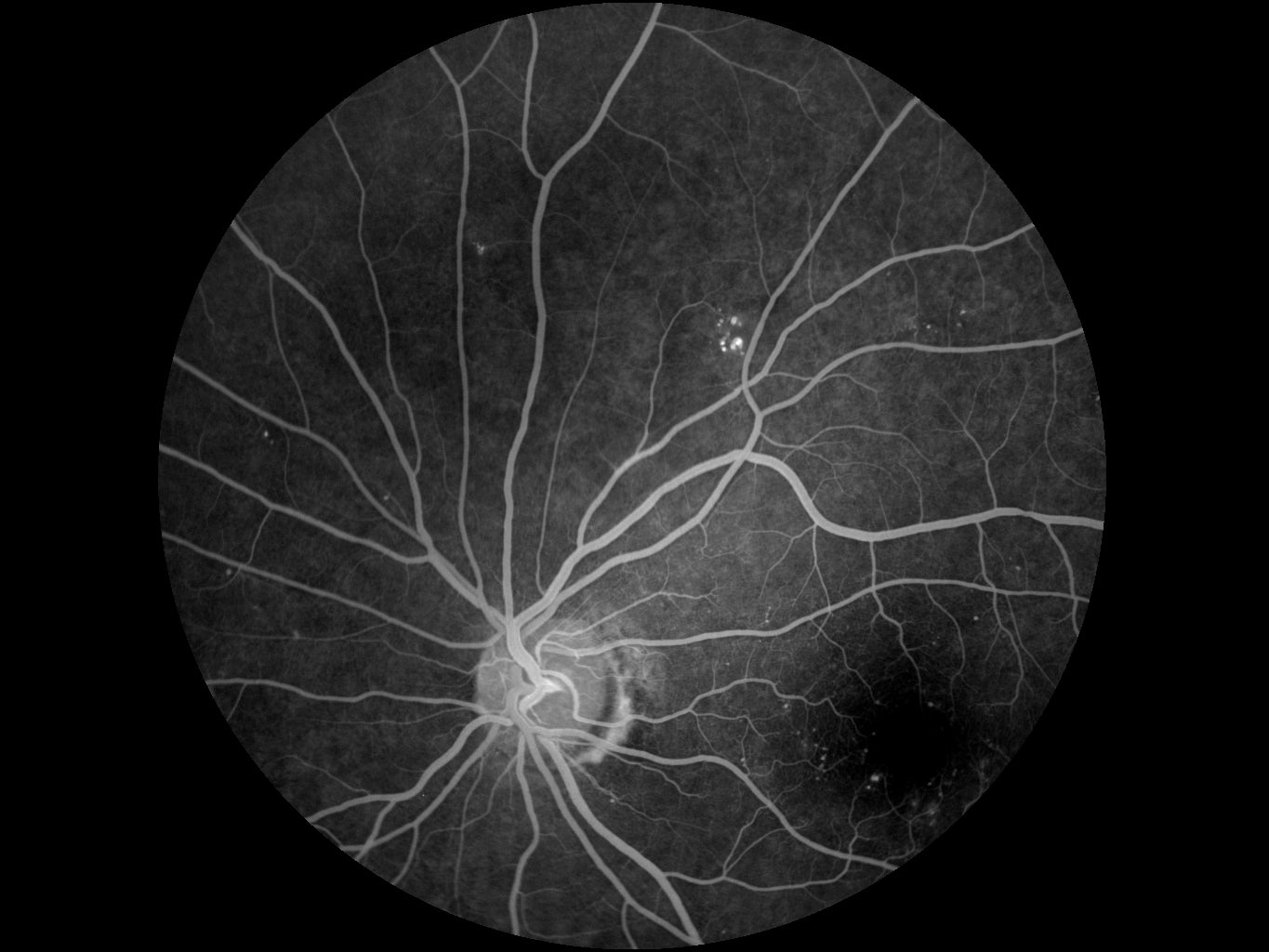 Cámara Retinal No Midriática + Angiográfo SK-650B
