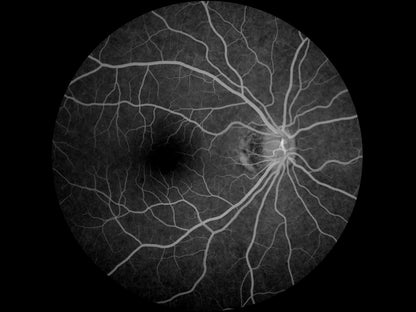 Cámara Retinal No Midriática + Angiográfo SK-650B