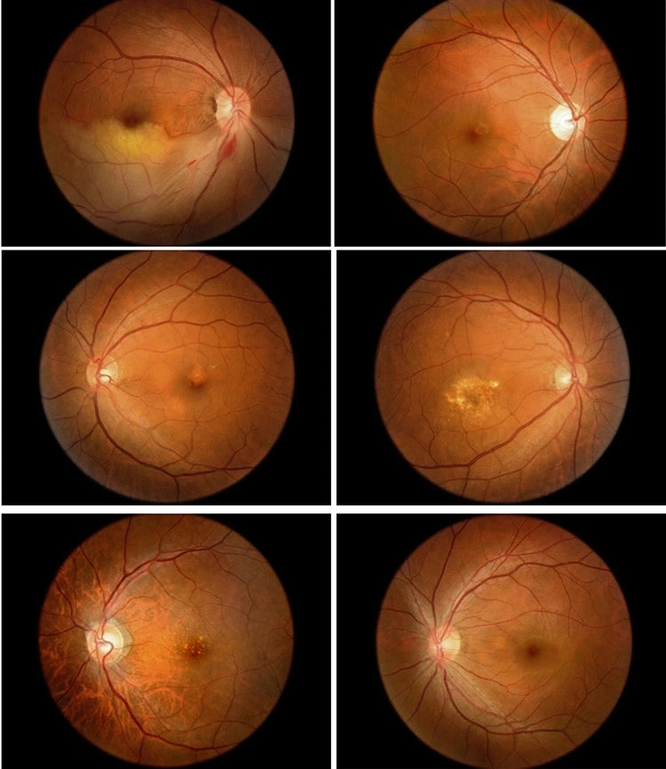 Cámara Retinal No Midriática AFC-AER