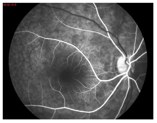 Cámara Retinal / Angiográfo AFC-AER +Plus