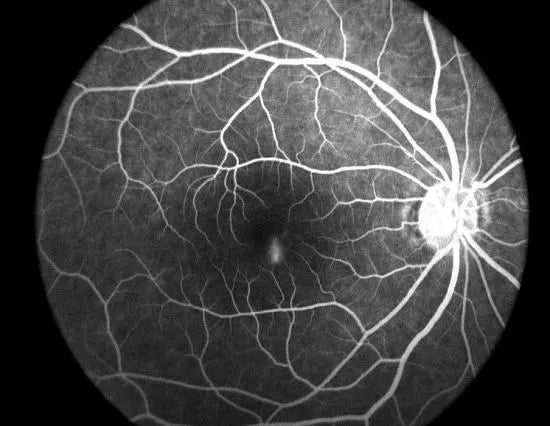 Cámara Retinal / Angiográfo AFC-AER +Plus