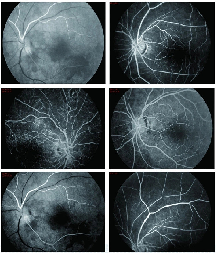 Cámara Retinal / Angiográfo AFC-AER +Plus