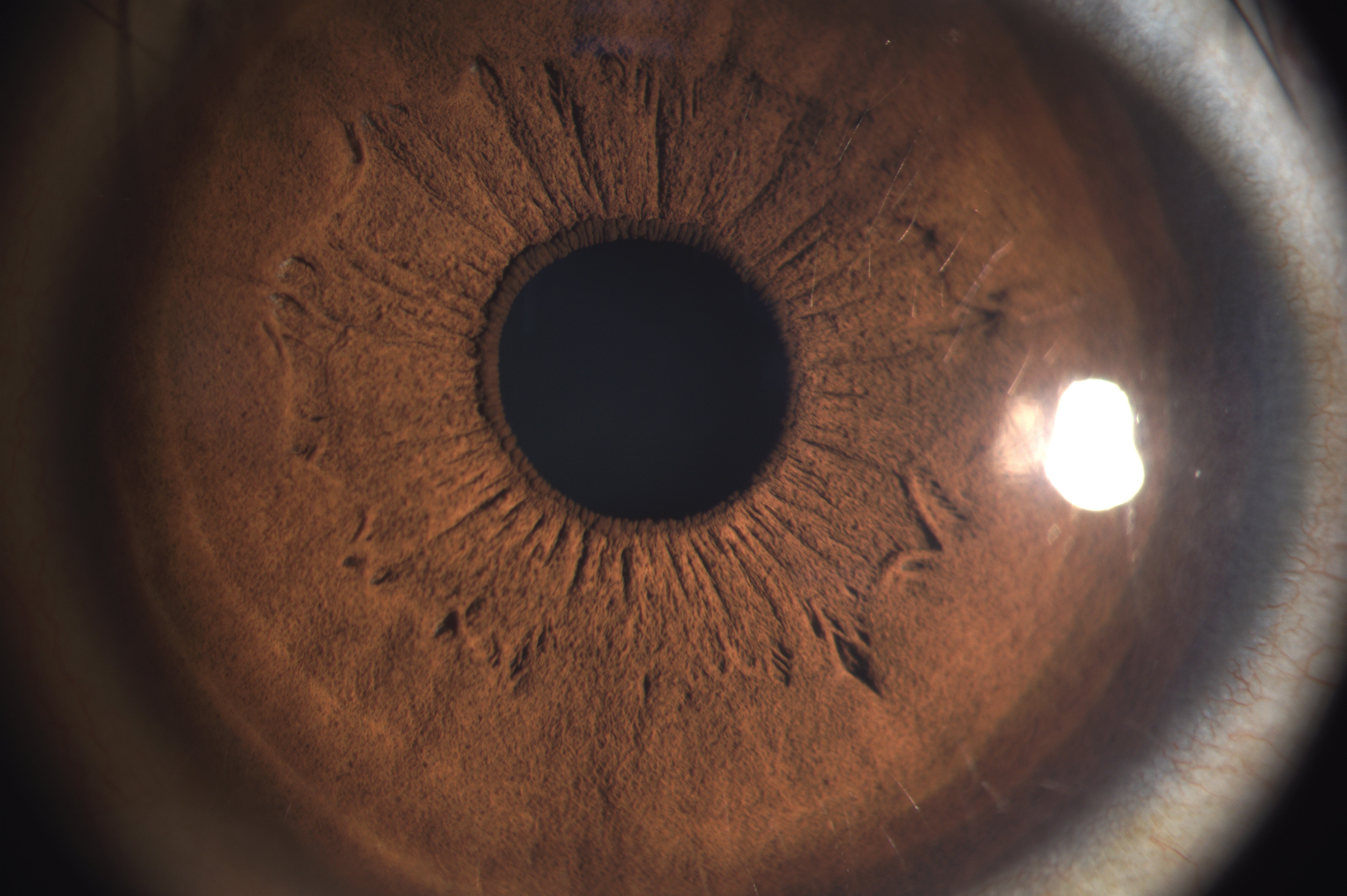 Analizador de Superficie Ocular DA-1