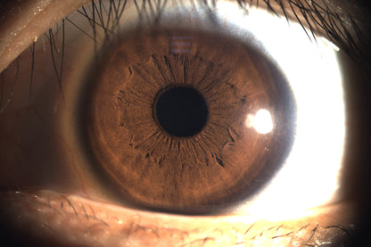 Analizador de Superficie Ocular DA-1