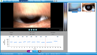 Analizador de Superficie Ocular Avanzado DA-3