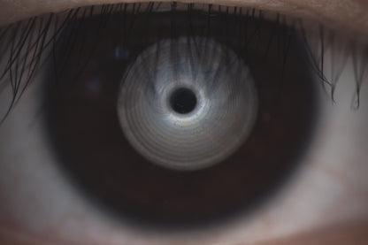 Analizador de Superficie Ocular DA-1