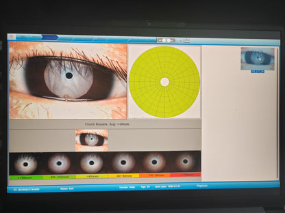 Analizador de Superficie Ocular Portátil DA-2