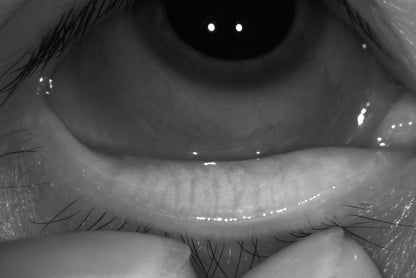 Analizador de Superficie Ocular Avanzado DA-3