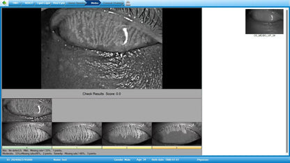 Analizador de Superficie Ocular Portátil DA-2