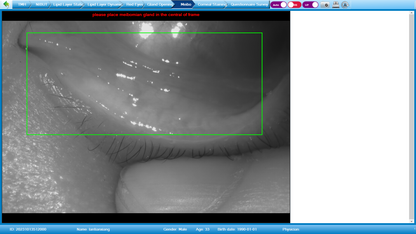 Analizador de Superficie Ocular Avanzado DA-3