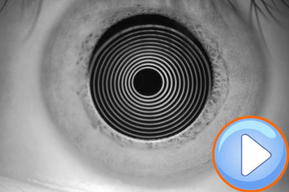 Analizador de Superficie Ocular DA-1