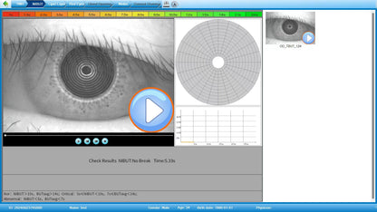 Analizador de Superficie Ocular Portátil DA-2