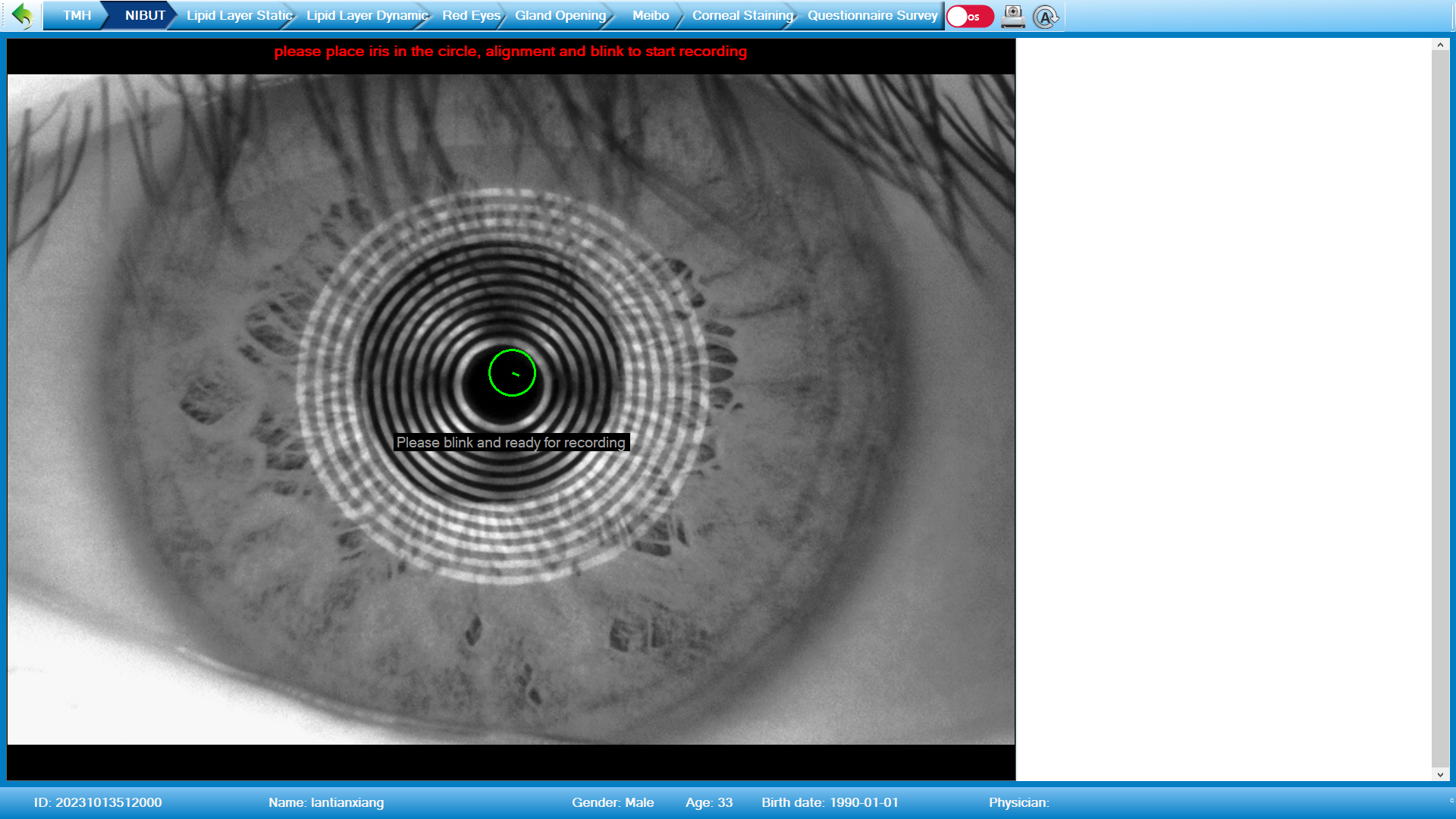 Analizador de Superficie Ocular Avanzado DA-3