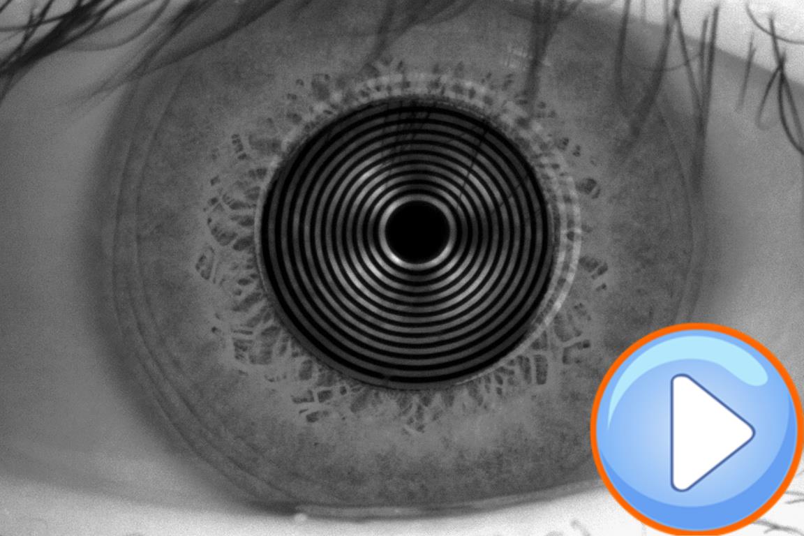 Analizador de Superficie Ocular Avanzado DA-3