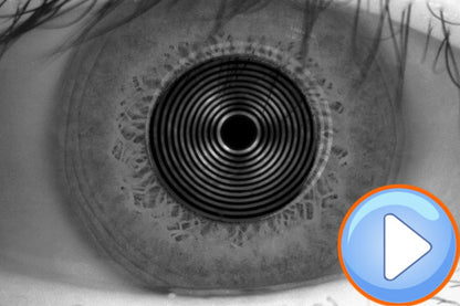 Analizador de Superficie Ocular Avanzado DA-3